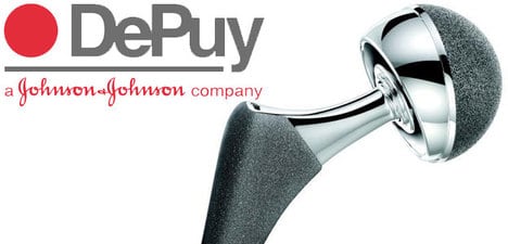 Depuy Hip Prosthesis